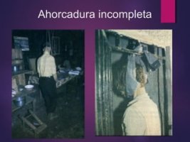 Ahorcadura incompleta Ahorcadura incompleta