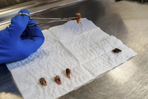 Dientes extraídos a Miguel Ángel en una autopsia Dientes extraídos a Miguel Ángel en una autopsia